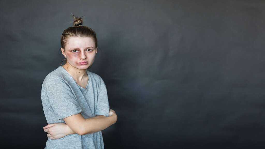 Siginma Evi Yas Siniri 2